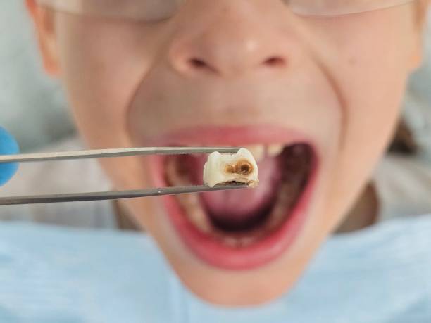 Best Weekend Emergency Dental Services in Stafford Courthouse, VA